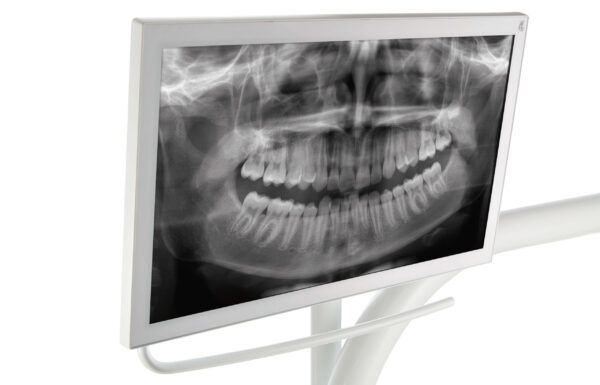 KaVo E80 Vision unit, hengende slanger eller Cart model - Bilde 7
