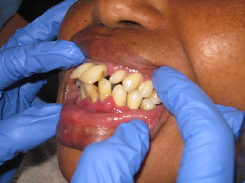 Blindheim-2011-3-800x600