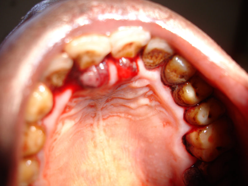 Grønnli-2009-6-800x600