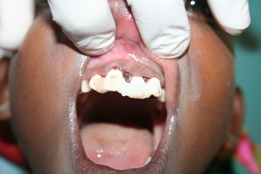 Kongsnes-2011-10-860x573