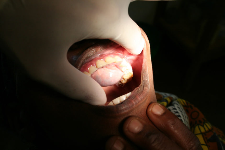 Kongsnes-2011-32-860x573