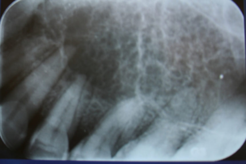 Kongsnes-2011-34-860x573