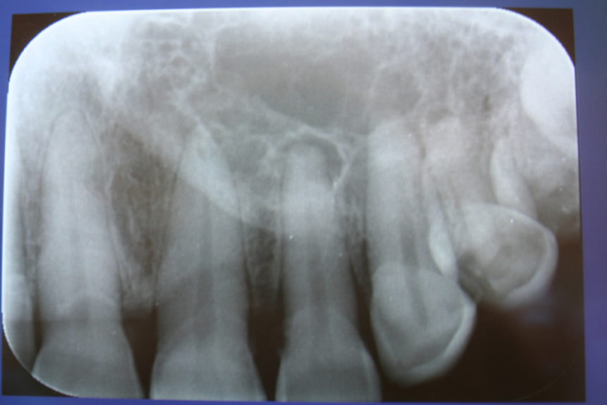 Kongsnes-2011-35-860x573