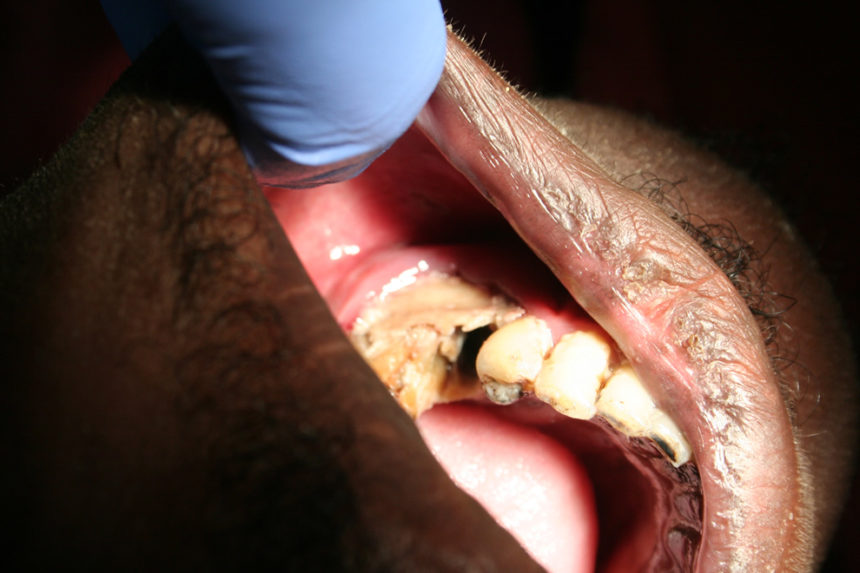 Kongsnes-2011-5-860x573