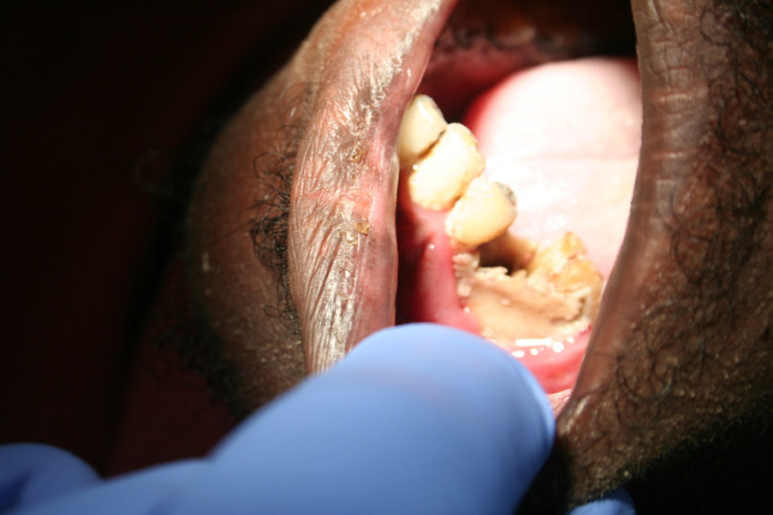 Kongsnes-2011-6-860x573