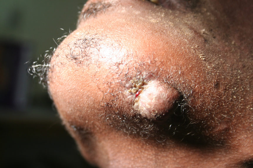 Kongsnes-2011-7-860x573