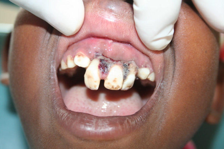 Kongsnes-2011-9-860x573