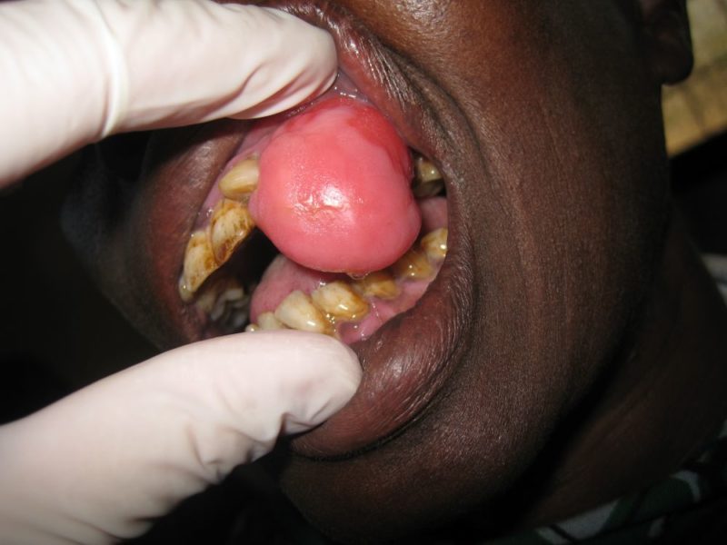 Møller-2010-3-800x600