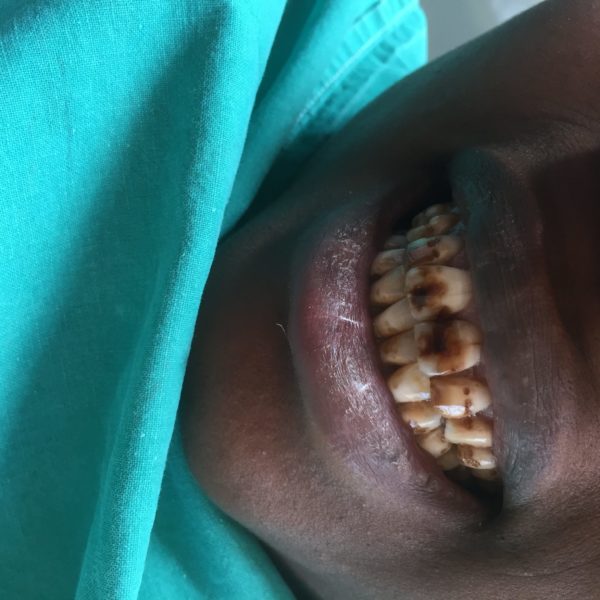 Tregde-2016-3-e1485258890539-600x600 (1)